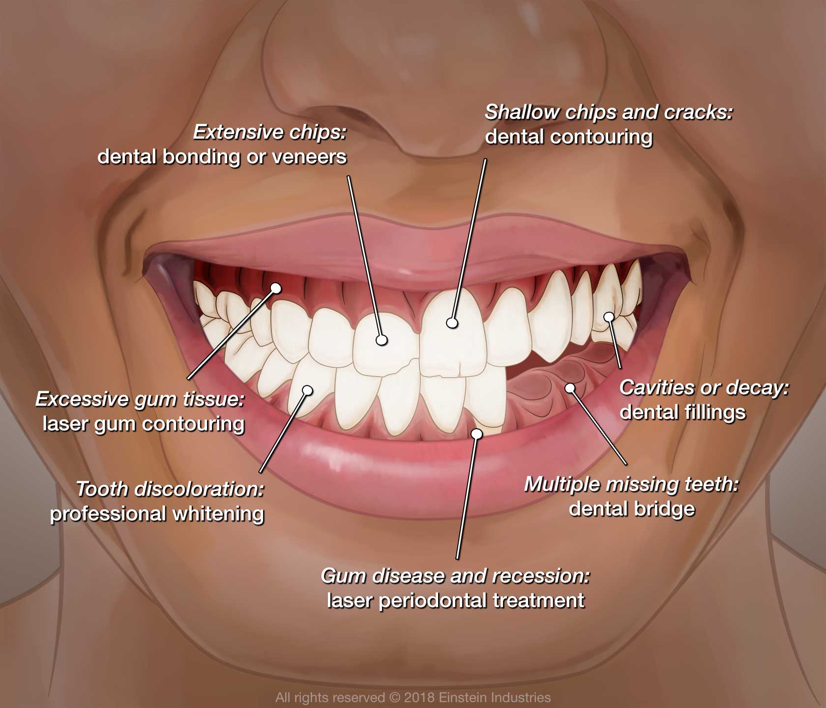 An illustration of different smile makeover options